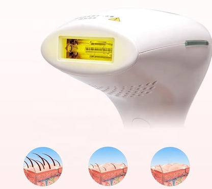 Professional IPL Laser Hair Removal Device | Full Body