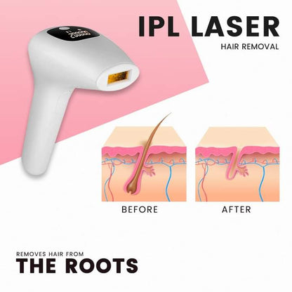 Professional IPL Laser Hair Removal Device | Full Body